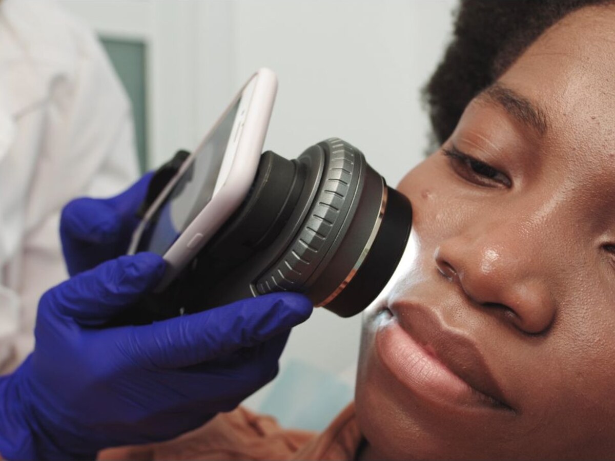 Dermatology